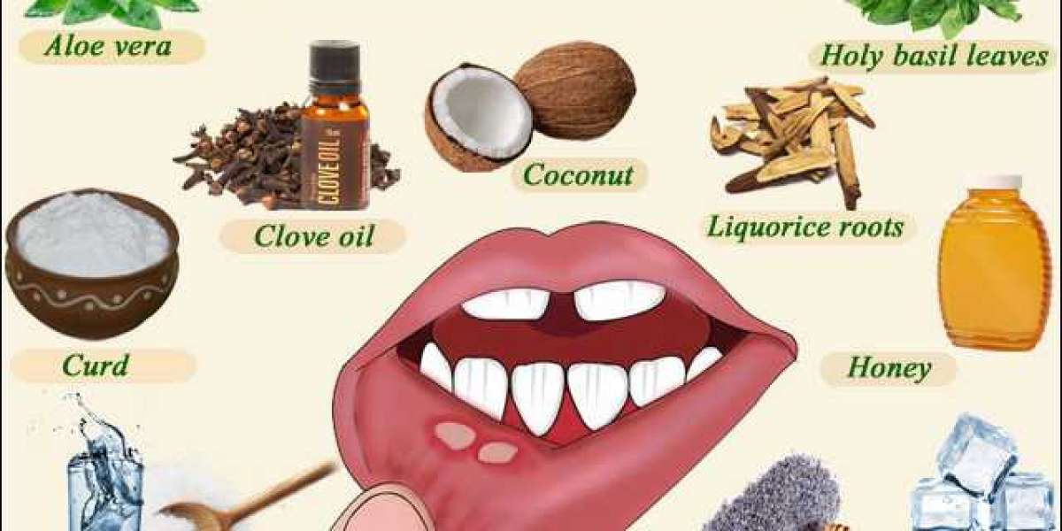 Natural Remedies For Mouth Ulcers