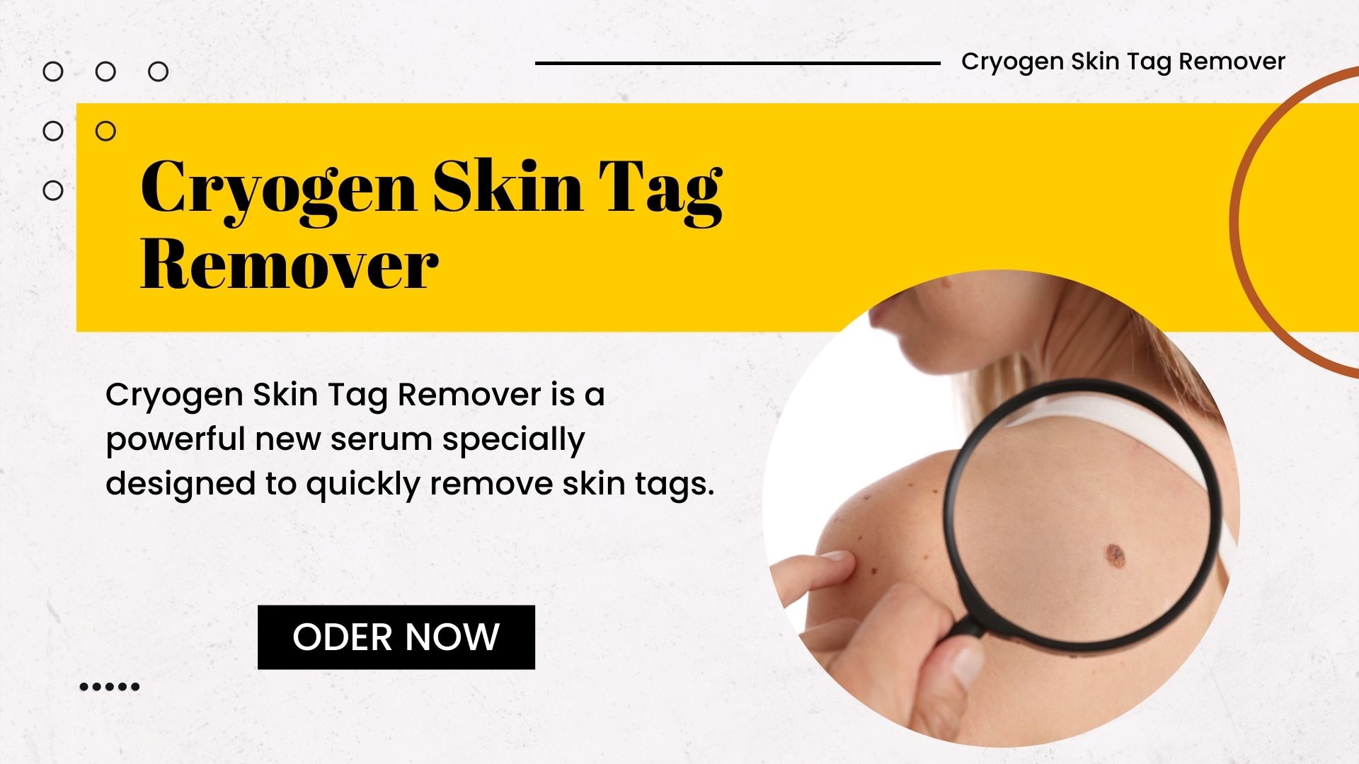 [Shark-Tank]#1 Cryogen Skin Tag Remover - Natural & 100% Safe
